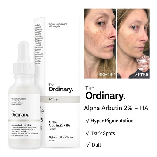 The Ordinary Alpha Arbutin 2% + HA 30Ml