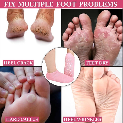 Spa Gel Socks – Intensive Moisturizing Foot & Heel Care