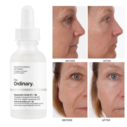 The Ordinary Hyaluronic Acid 2% + B5 - 30Ml