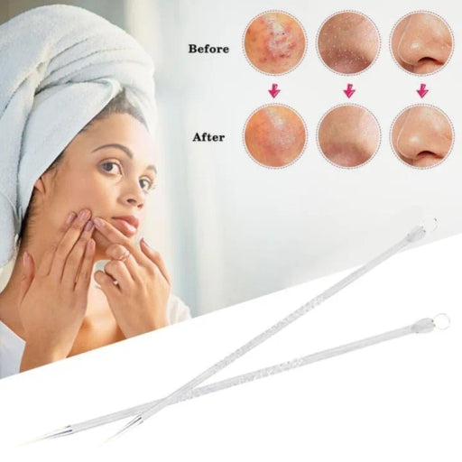 2PCS Double-Sided Stainless Steel Blackhead & Acne Remover Comedone Extractor Set
