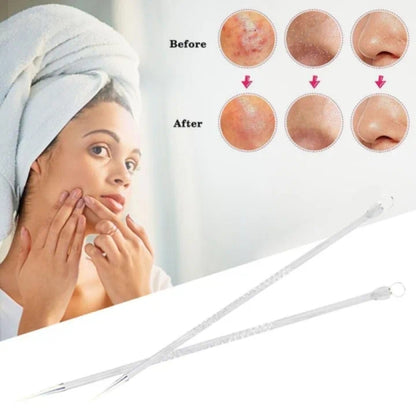 2PCS Double-Sided Stainless Steel Blackhead & Acne Remover Comedone Extractor Set