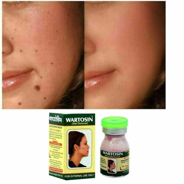 Moisturizers and Cream ( Wart Remover) 3Ml