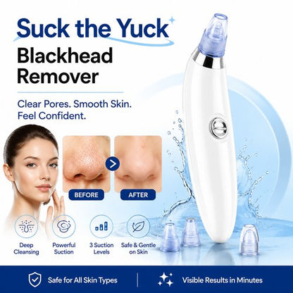Blackhead Remover Pore Vacuum – Battery Powered Facial Suction Tool for Clear, Smooth Skin