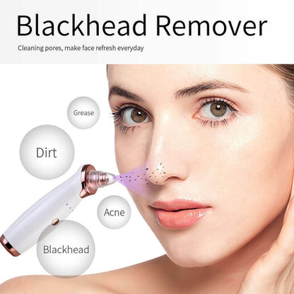 Electric Blackhead Remover Vacuum – USB Rechargeable Pore Cleaner