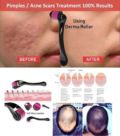 Derma Roller System – Facial Skin, Beard & Scalp Care