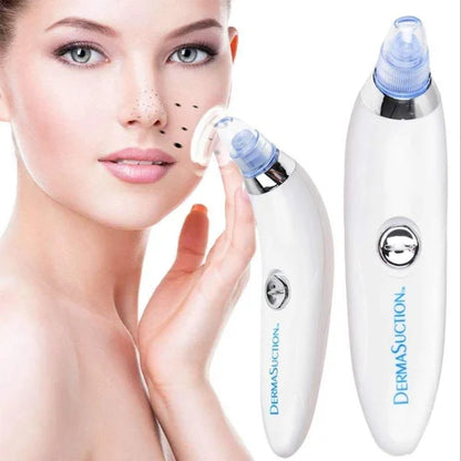 Derma Suction 4-in-1 Pore Cleanser | Blackhead & Whitehead Vacuum Extractor